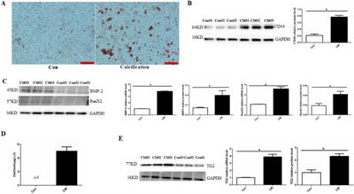 Transglutaminase 2 regulates endothelial cell calcification via IL-6-mediated autophagy